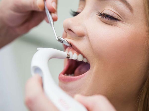 不去洗牙也能让牙齿快速变白的小妙招